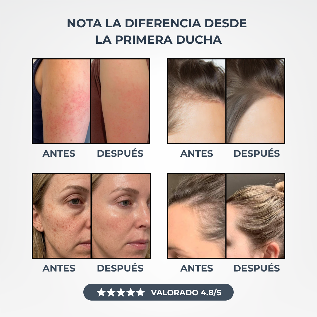 Ducha Anti Cal